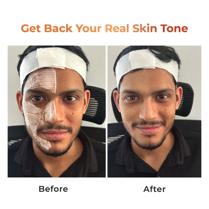 Niconi Skin Polish Results