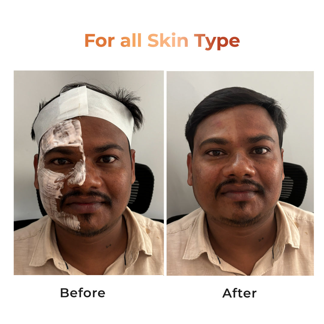 Niconi Skin Polish How to Use