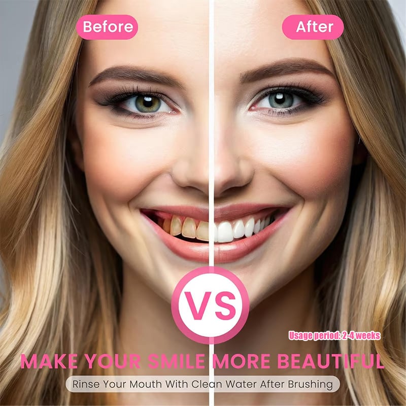 Niacinamide Whitening Toothpaste - For Healthier & Whiter Teeth! SNAPnMart