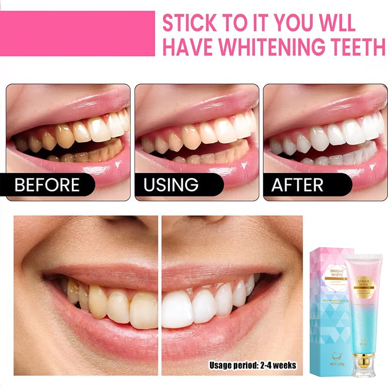 Niacinamide Whitening Toothpaste - For Healthier & Whiter Teeth! SNAPnMart